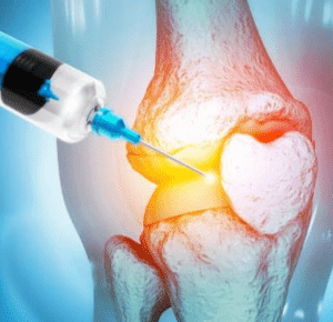 Knee Joint Pain Treatment in Hyderabad - Options for Relief and Recovery
