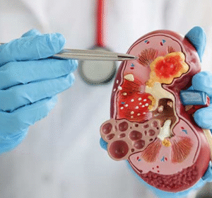 best nephrology hospital in hyderabad