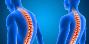 Back Pain Treatment