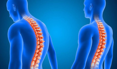 Back Pain Treatment